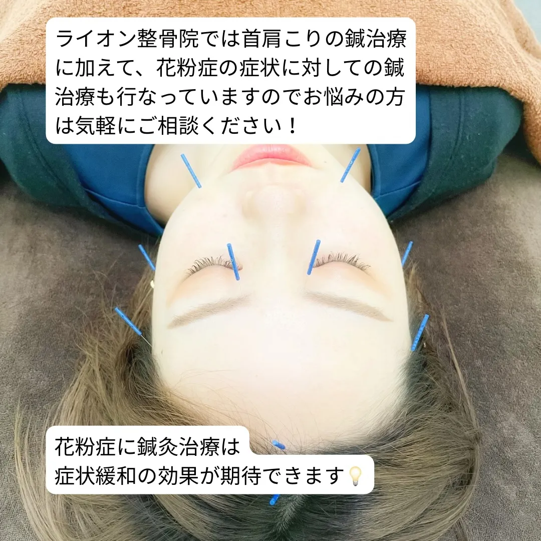「花粉症、首や肩までつらくなっていませんか？」⁡