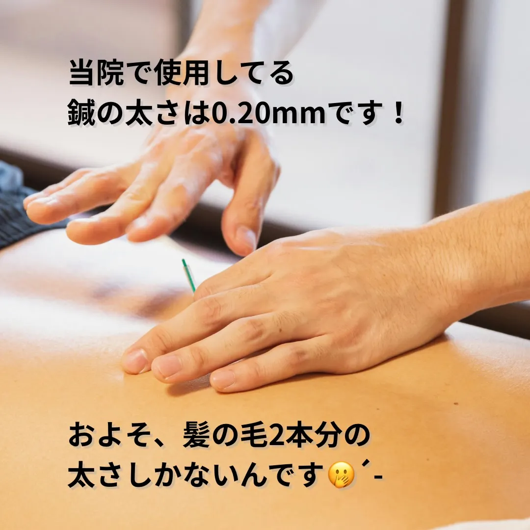 「鍼って痛そうで怖い…」